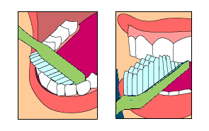 Brossage5[1]