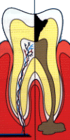 ENDO2[1]