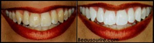 cdcvm_bleaching[1]