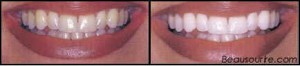 cdcvm_bleaching2[1]