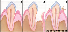 cdcvm_gumsurg1[1]