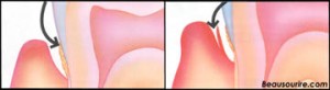 cdcvm_gumsurg3[1]