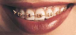 ortho_gold[1]