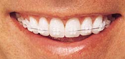 ortho_inspire_Closeup[1]