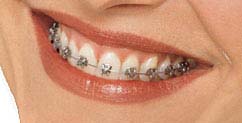 ortho_smile_regular[1]