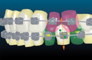 orthodontie-informatisé